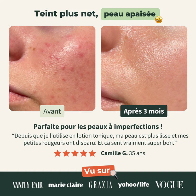 Eau florale de Lavande Bionoble Résultats